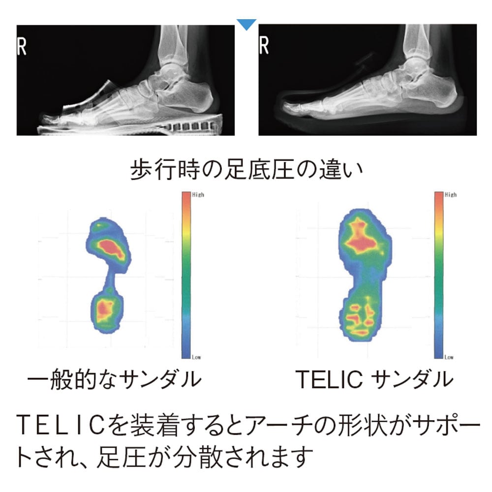 アーチの形状がサポ―トされ、足圧が分散されます